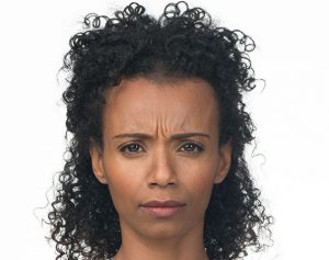 Botox Before Photo